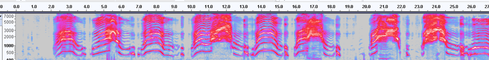 baby cry speech recognition model_baby coughs, screams, wails, breathes heavily spectogram